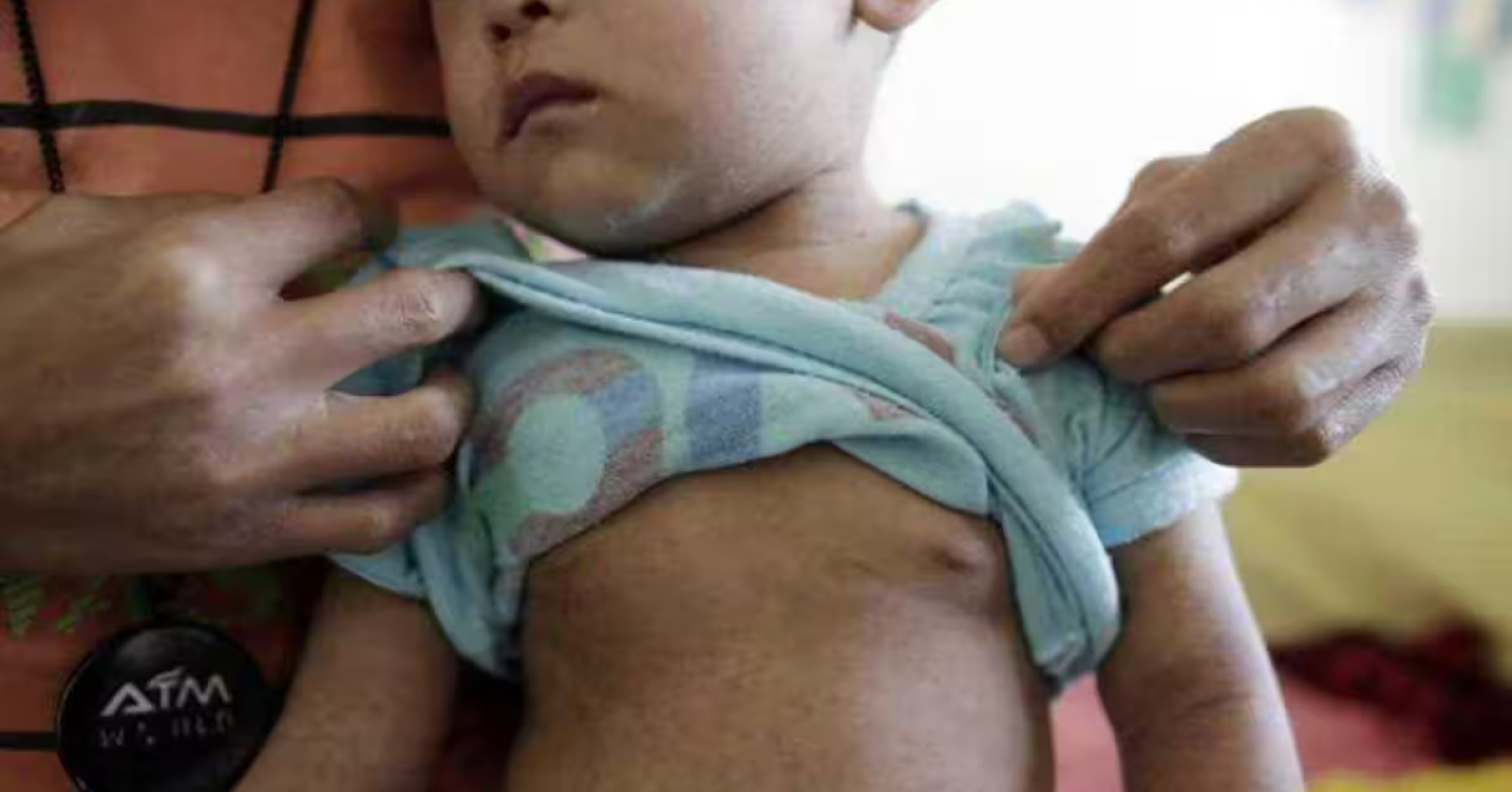 УЛААНБУРХАН ӨВЧНИЙ 51 ТОХИОЛДОЛ БАТЛАГДЛАА 